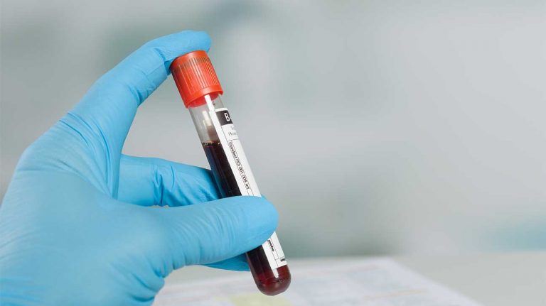 Can Heart Problems Be Detected In Blood Work