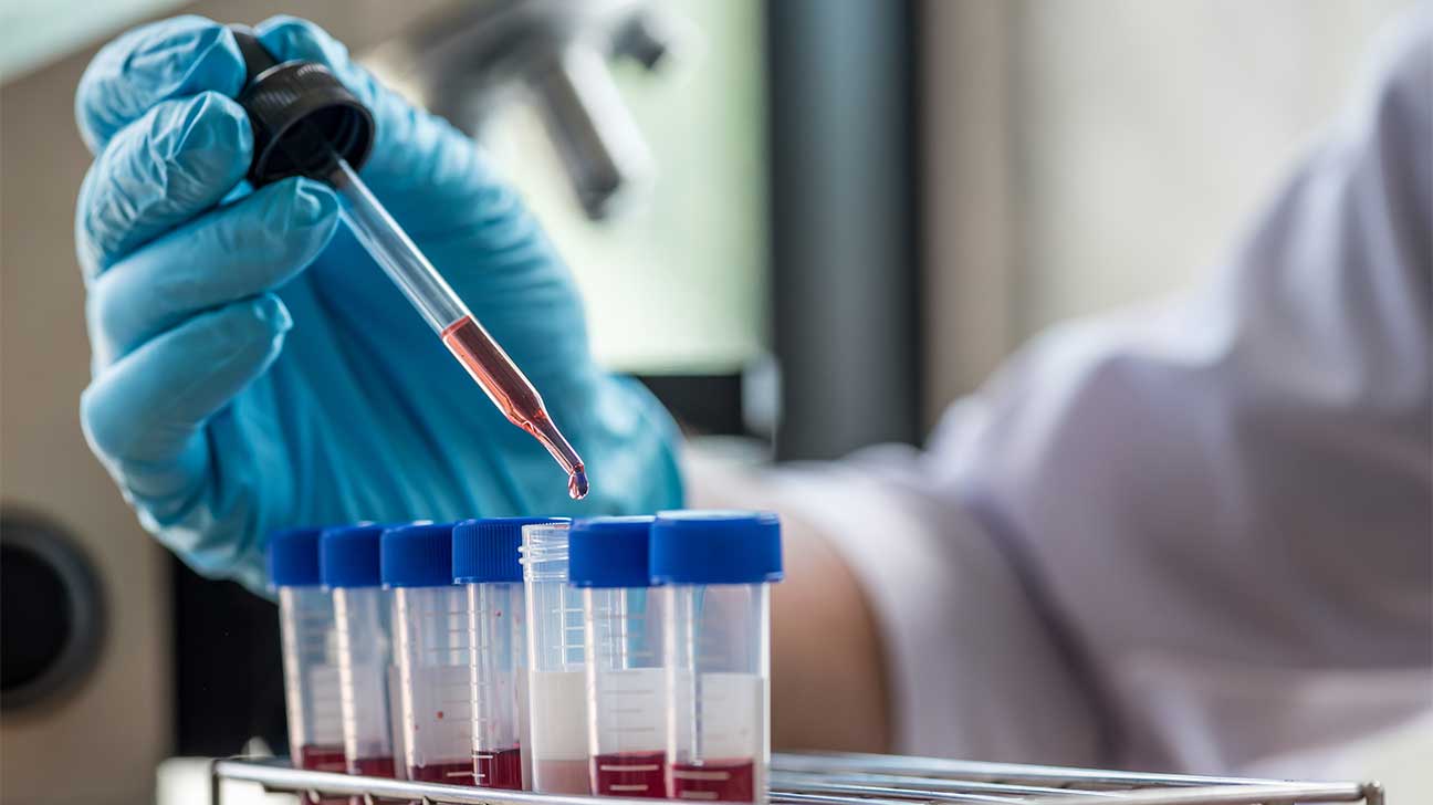 Detection Times For Blood Drug Tests