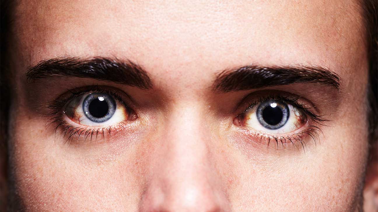 What Are Cocaine Eyes? Does Cocaine Dilate Your Pupils?