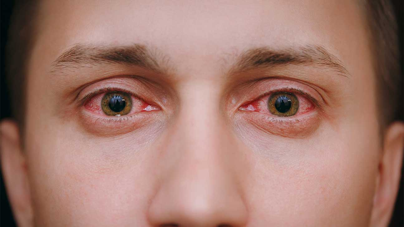 Meth Eyes: Does Meth Dilate Or Constrict Your Pupils?